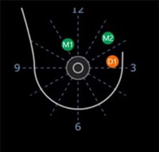 Precision-Reporting-img-BI-RADS Precision-Reporting-img-BI-RADS