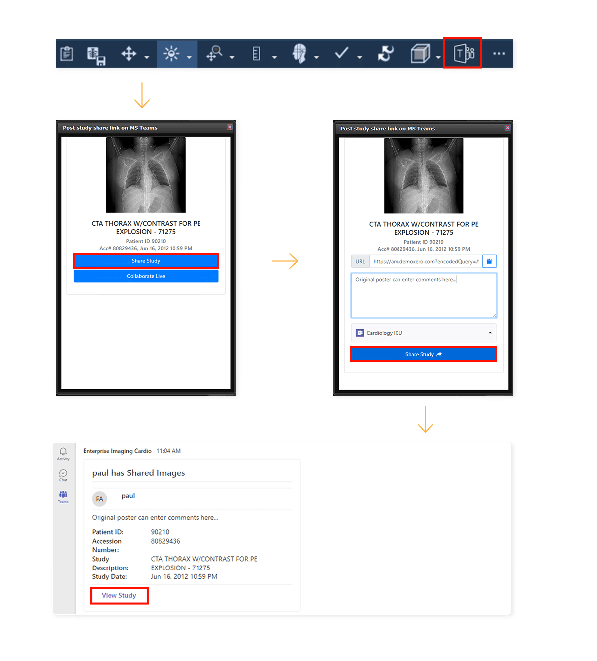 teams example case 1