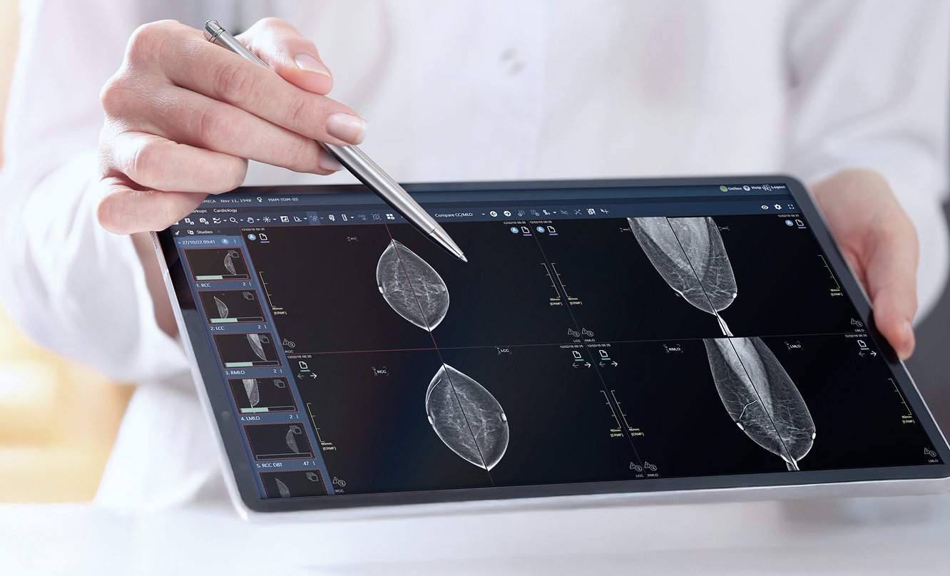 Orthopedic Surgery Planning (Materialise OrthoView)